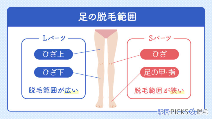 脱毛範囲が4つに分かれる